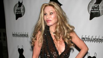 Τζόσλιν Γουάιλντενσταϊν: Η «γυναίκα γάτα»  δείχνει πώς ήταν πριν τις πλαστικές επεμβάσεις