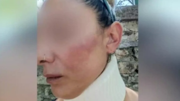 Λέσβος: Συνελήφθη ο πυροσβέστης που χτύπησε τη σύντροφό του και την έστειλε στο νοσοκομείο