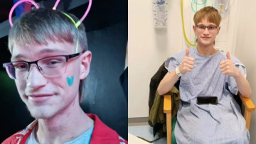 Ο 19χρονος Oli νόμιζε ότι είχε σεξουαλικό νόσημα – Τελικά ήταν καρκίνος των όρχεων που τον πρόλαβε στο «παρά πέντε»