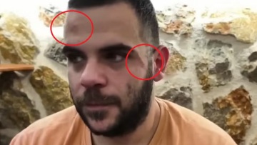 Ξυλοκόπησαν άγρια τον Youtuber Teosty σε live στα Γιάννενα: Τον χτύπησαν σε σώμα και πρόσωπο, εμφανίστηκε με μελανιές - Δείτε βίντεο
