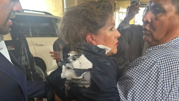 Σοβαρά τραυματισμένη βουλευτής από εκρηκτικό μηχανισμό στο Κοινοβούλιο της Ονδούρας, δείτε βίντεο