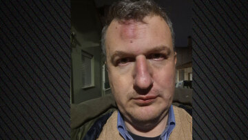 Θύμα ξυλοδαρμού έπεσε εκδότης τοπικής εφημερίδας στον Βόλο