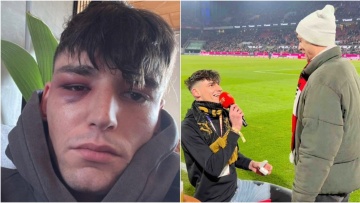 Ομοφοβική επίθεση: Μέσα στο ίδιο του το σπίτι ξυλοκόπησαν τον Γερμανό διαιτητή που έκανε πρόταση γάμου στον φίλο του σε αγώνα της Bundesliga
