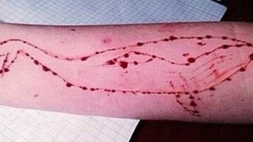 Η «Μπλε Φάλαινα» στην Ελλάδα: Μία 15χρονη το πρώτο θύμα του διαδικτυακού «παιχνιδιού»