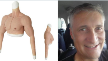 Ο Ιταλός που έβαλε ψεύτικο χέρι για να αποφύγει το εμβόλιο λέει τώρα ότι τον... κατέστρεψαν οι δημοσιογράφοι!