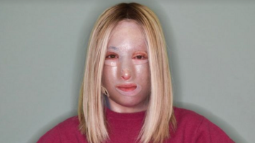 Ιωάννα Παλιοσπύρου: «Ακόμα εδώ... το παλεύω» - Η πρώτη φωτογραφία μετά το νέο της χειρουργείο