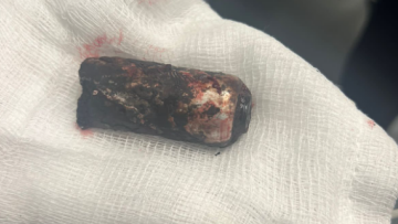 Η ναυτική φωτοβολίδα που τραυμάτισε τον αστυνομικό στα επεισόδια με τους χούλιγκαν στου Ρέντη - Φωτογραφία