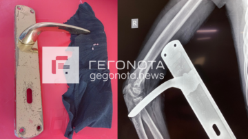 Βόλος: Πόμολο καρφώθηκε σε χέρι μαθητή - Μεταφέρθηκε στο νοσοκομείο