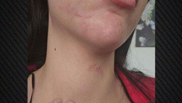 Έδεσσα: Στο εδώλιο του δικαστηρίου ο 34χρονος που κατηγορείται ότι ξυλοκόπησε τη σύντροφό του