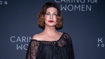 Λίντα Εβαντζελίστα: «Οι φίλοι μου με έκαναν να νιώσω όμορφη όταν έδειξα για πρώτη φορά τις ουλές από τη μαστεκτομή»