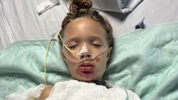 Περιπέτεια για 7χρονη στις ΗΠΑ μετά από challenge στο TikTok: Την έβαλαν σε τεχνητό κώμα, δείτε φωτογραφίες