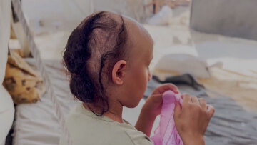 «Μαμά, έχω κουραστεί, θέλω να πεθάνω»: Το δραμα των παιδιών της Γάζας μέσα από την ιστορία της μικρής Σάμα