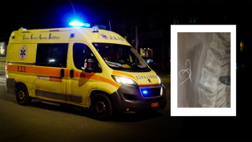 Διακομιδή στην Αθήνα για 38χρονο από το Αγρίνιο που έφαγε χταπόδι με άγκιστρο - Δείτε την ακτινογραφία