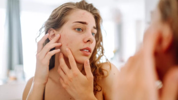 Μικροπλαστικά: Τρομακτικές φωτογραφίες αποκαλύπτουν τι προκαλούν σε πρόσωπο και σώμα