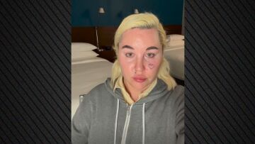 Η Αμάντα Μπάινς άνοιξε λογαριασμό στο OnlyFans