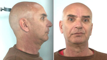 Σαλαμίνα: Συνελήφθη εργοθεραπευτής που ασέλγησε σε ανήλικη με αναπηρία