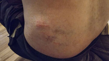 Επιχειρηματίας στη Μύκονο καταγγέλλει ξυλοδαρμό από αστυνομικούς - Τι απαντά η ΕΛΑΣ
