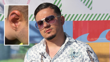 Φωτογραφίες: Τα σημάδια στο σώμα του 24χρονου από τα βασανιστήρια που του έκαναν οι απαγωγείς με τον  Ivan Greko