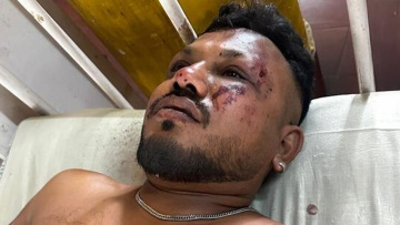 Ο επιβάτης της θέσης 11Α - Αυτός είναι ο μοναδικός επιζών της αεροπορικής τραγωδίας στην Ινδία
