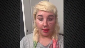 Η Αμάντα Μπάινς ανακοίνωσε ότι θα κάνει χρήση Ozempic  - Ζυγίζει 173 κιλά και ελπίζει να φτάσει στα 130