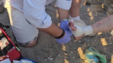 Θαλάσσια χελώνα επιτέθηκε σε λουόμενη σε παραλία της Αναβύσσου - Την τραυμάτισε σοβαρά στο πόδι