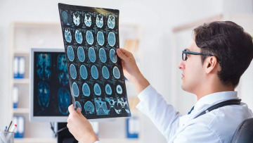 Αδιόρατα σημάδια άνοιας που μπορεί να εμφανιστούν από τα 30 – Έρευνα αποκαλύπτει