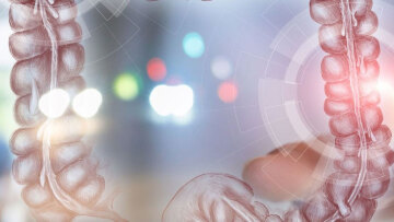 Εκκολπωμάτωση παχέος εντέρου: Παράγοντες κινδύνου και θεραπευτικές επιλογές
