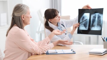 Καρκίνος πνεύμονα: Όταν ο «ένοχος» δεν είναι το τσιγάρο – Τρεις ειδικοί εξηγούν την εμφάνισή του σε μη καπνιστές
