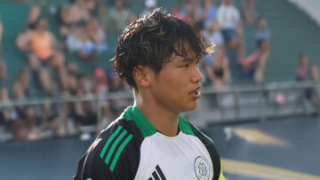 Ζέσταμα με τα... μάτια: Η ιδιαίτερη προθέρμανση του Χατάτε της Σέλτικ που δημιούργησε ερωτηματικά