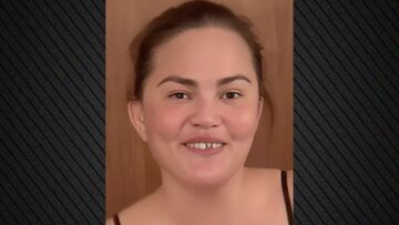 Κρίσι Τέιγκεν: Το μοντέλο έμεινε... χωρίς δόντι: «Αυτά κάνουν οι μαμάδες για τα παιδιά τους»