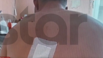 Τροχαίο με εγκατάλειψη στο Πικέρμι: «Πονάω αφόρητα, παραμορφώθηκα» λέει ο 22χρονος Άγγελος 