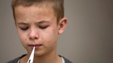 Η ιλαρά σε άνοδο στην Ευρώπη: 7.655 κρούσματα το 2025 – Ποιες χώρες «χτυπά» περισσότερο