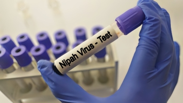 Ιός Νίπα: «Ο κίνδυνος εξάπλωσής του σε παγκόσμιο επίπεδο είναι χαμηλός», σύμφωνα με τον ΠΟΥ