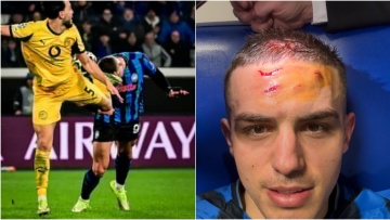 Αταλάντα: Η σοκαριστική φωτογραφία του Κρστόβιτς από την κλωτσιά του Μπενσεμπαϊνί
