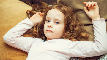 Ιλαρά: Οι ΗΠΑ ξεπέρασαν τα 1.100 κρούσματα μέσα σε 2 μήνες – Αναμένονται νέοι θάνατοι