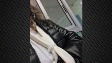 «Αν δεν ήταν η κόρη μου θα με είχαν κατασπαράξει», λέει η γυναίκα που δέχθηκε επίθεση από αδέσποτα σκυλιά στην Πυλαία