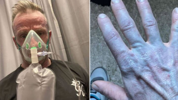 Ξύπνησε και ήταν όλος μπλε: Όταν πήγε στο νοσοκομείο οι γιατροί έκλαψαν από τα γέλια