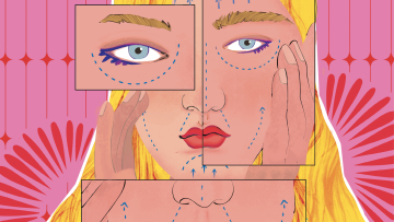 Στην ηλικία που οι γυναίκες δεν χρειάζονται ούτε κραγιόν τα κορίτσια σήμερα κάνουν αισθητικές επεμβάσεις