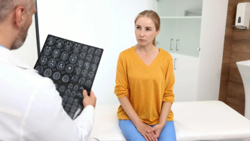 Εγκεφαλικά επεισόδια: Ευρωπαϊκό σχέδιο με στόχο 15% μείωση έως το 2030