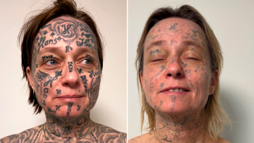 Απίστευτη κακοποίηση στην Ολλανδία: Έκανε τατουάζ 250 φορές το όνομά του στο κορμί της κοπέλας του!