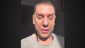 Γιώργος Μαζωνάκης: Μην ξανακούσω κανέναν να λέει ότι δεν θα γίνει η συναυλία μου λόγω του ματιού μου, θα του κόψω το κεφάλι 