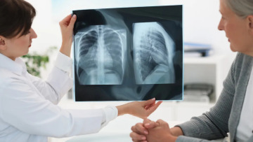 Πόσα λίγα γνωρίζουμε για τον συχνότερο καρκίνο στους άνδρες – Νέα έρευνα για τις ανάγκες των ασθενών στην Ελλάδα