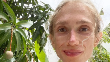 Φρουταριανισμός: H 27χρονη φοιτήτρια που λιμοκτόνησε στο Μπαλί