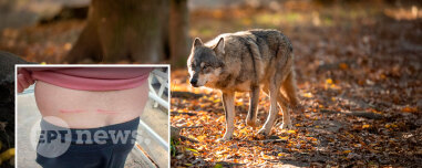 «Μου έσκισε τη μπλούζα και μου έκανε γρατζουνιές»: Πώς σώθηκε ο άνδρας που δέχθηκε επίθεση από λύκο στο Τατόι