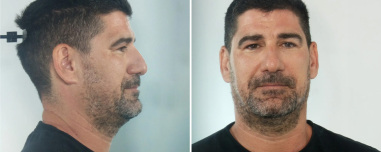 Για βιασμούς ανήλικων αθλητριών κατ’ εξακολούθηση διώκεται ο προπονητής στην Κεφαλονιά, στη δημοσιότητα τα στοιχεία του