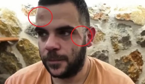 Ξυλοκόπησαν άγρια τον Youtuber Teosty σε live στα Γιάννενα: Τον χτύπησαν σε σώμα και πρόσωπο, εμφανίστηκε με μελανιές - Δείτε βίντεο
