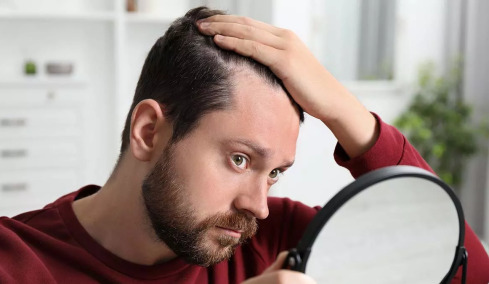 Τριχόπτωση τέλος – Καινοτόμος ορός αναγεννά την τρίχα σε 20 μέρες
