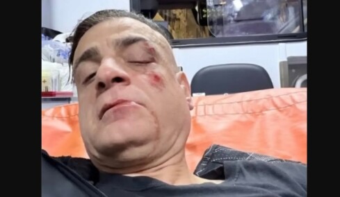 Άγριος ξυλοδαρμός Youtuber στο μετρό της Ρώμης - Του επιτέθηκαν οι πορτοφολάδες που βιντεοσκοπούσε, δείτε βίντεο