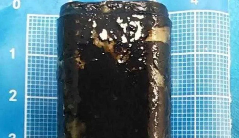 Κίνα: Κατάπιε αναπτήρα για challenge και 30 χρόνια μετά λειτουργούσε