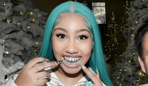 Κιμ Καρντάσιαν: Η 12χρονη κόρη της, Νορθ Γουέστ πόζαρε με μπλε μαλλιά, μακριά νύχια... και διαμαντένια οδοντοστοιχία